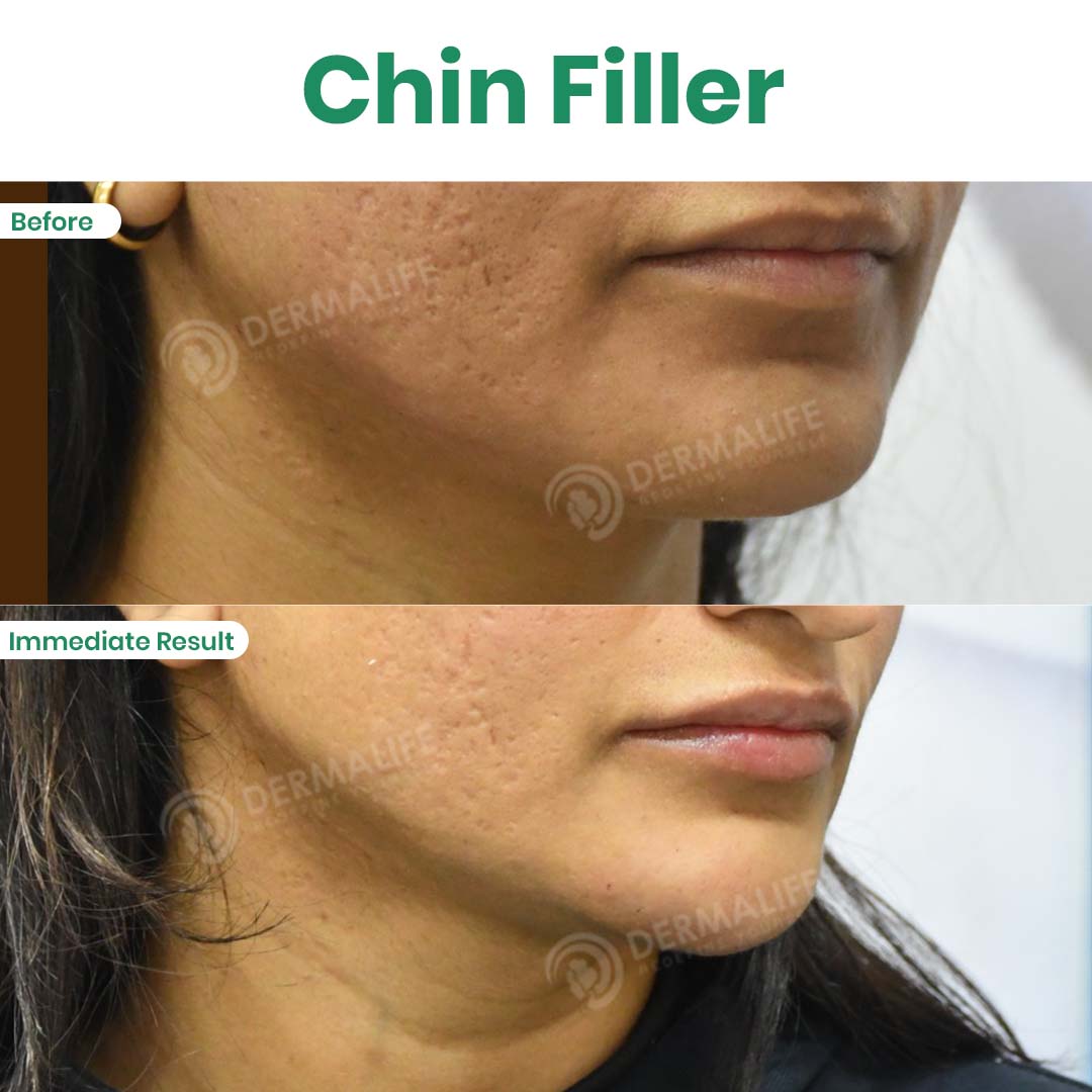 Dr Gaurav Garg(Dermalife) tweet media