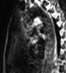 Elias Stråvik tweet media