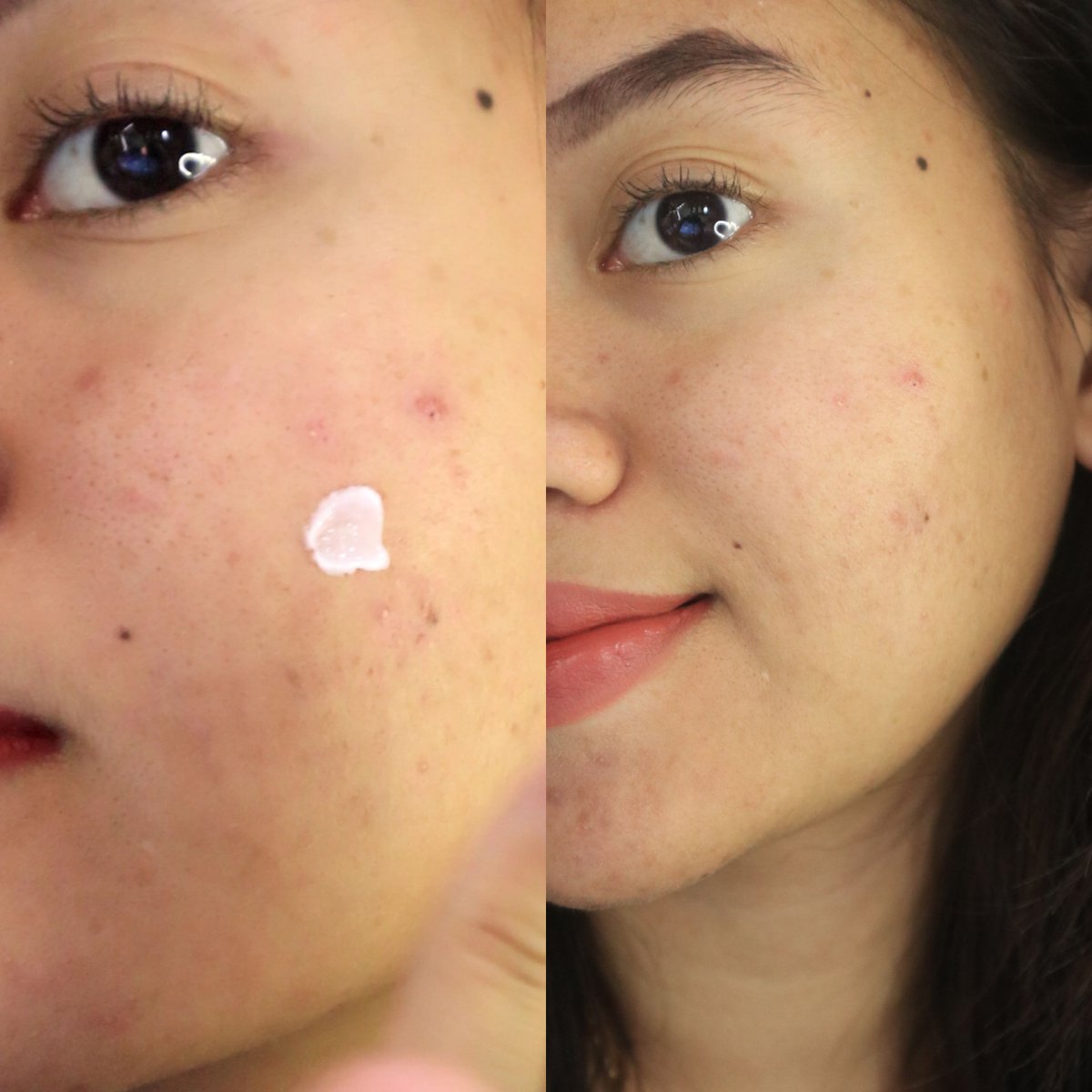 Zulfamuu's tweet image. glad to know Theraskin punya AHA Cream!!

gentle di kulit aku yang sensitif, eksfoliasi jadi comfyyy ga was-was kulit bakal rewel✨️