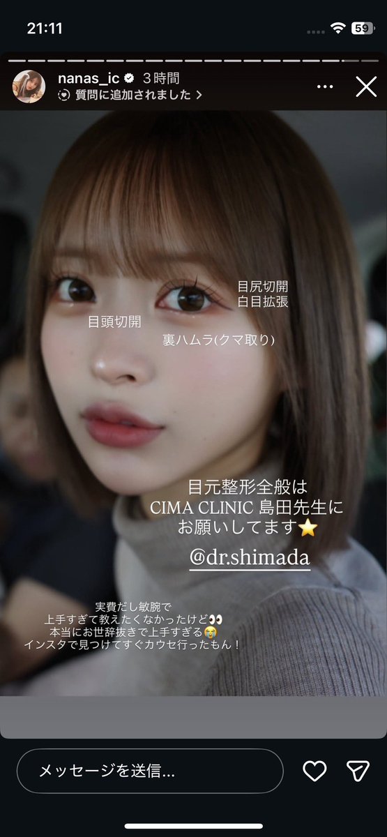 linneaabyrd's tweet image. 🌳🗼ななにーちゃんの整形遍歴はこちら⤵️
バブみ強くて整形のセンスが本当にいい、、。