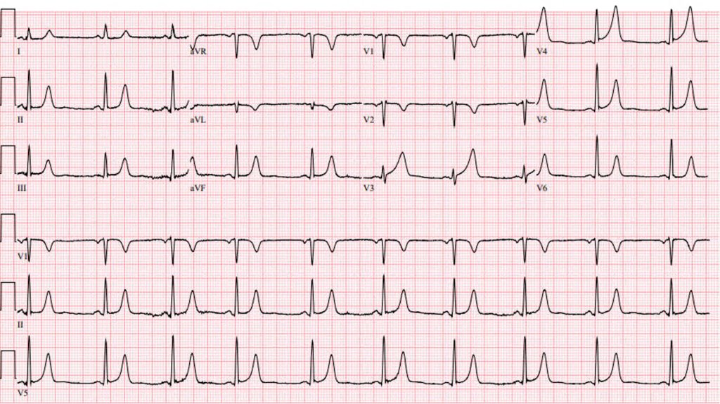 ECGWeekly tweet media