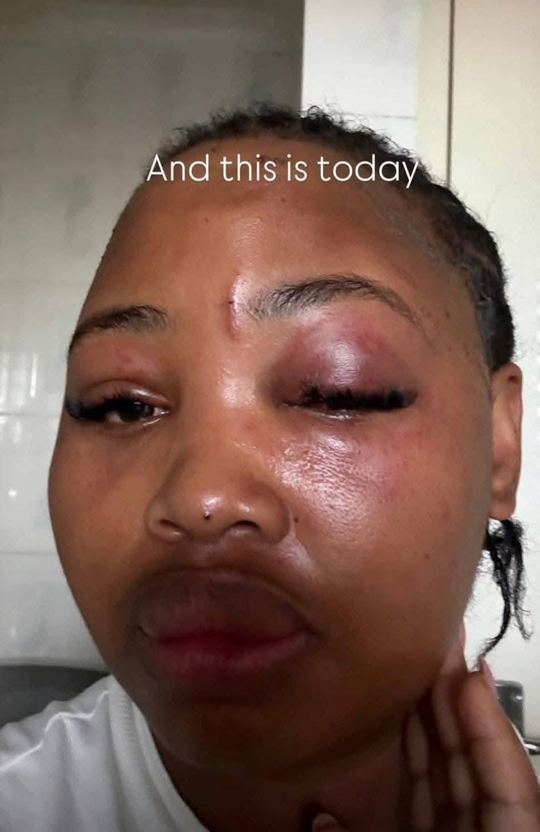 Am_Blujay's tweet photo. Damn What a toxic relationship, he was assaulting and abusing her and she also set his car on fire , someone was gonna die if the relationship continued 😓😓 https://t.co/T3jA4CeuMh