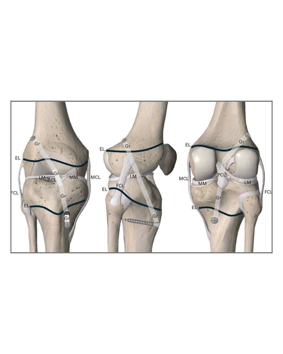 The Bone & Joint Journal tweet media