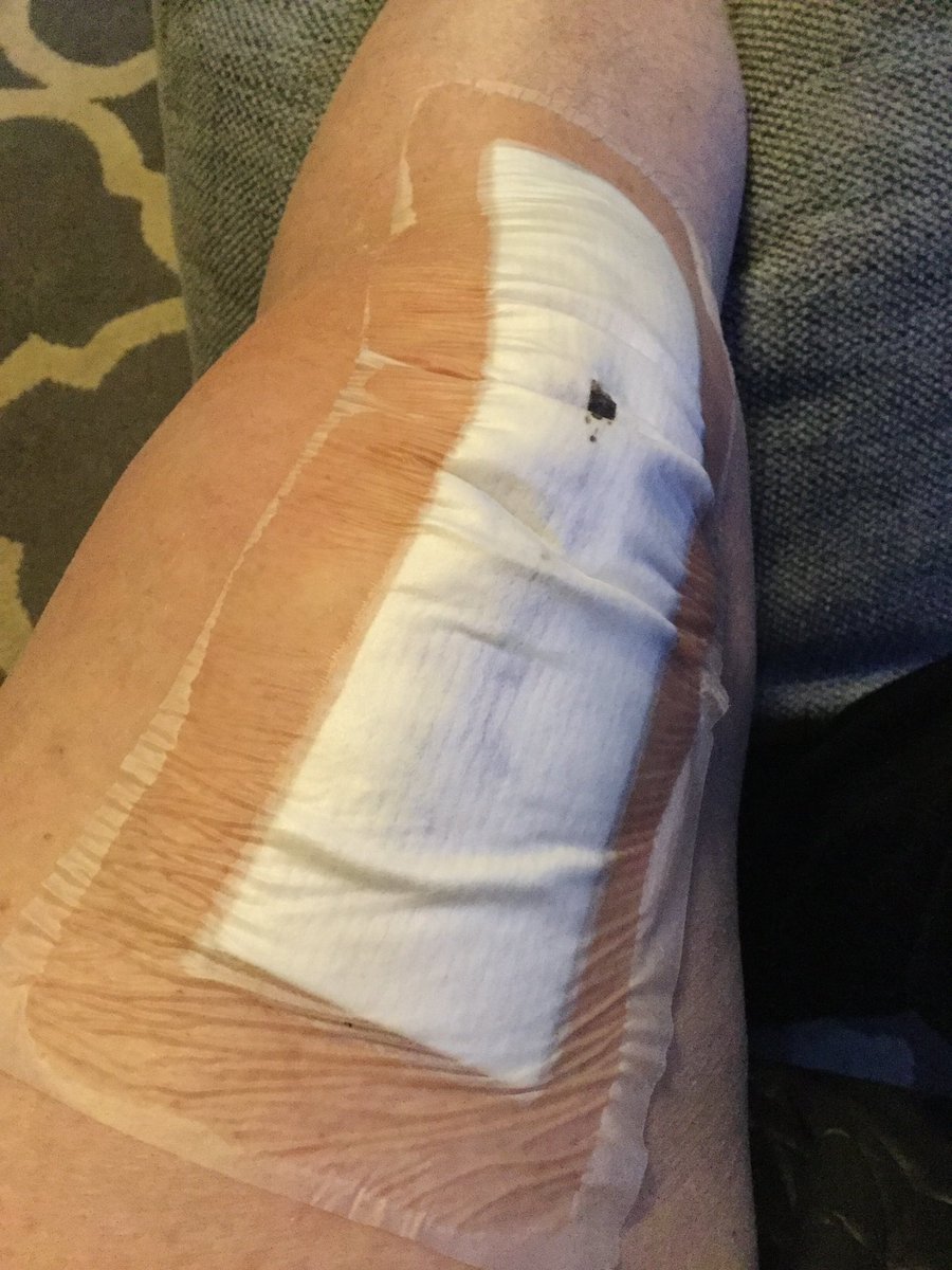 kiasazand's tweet photo. @DailyPicTheme2 My family had a bit of a #visceral reaction to my knee replacement dressing! I was just glad to have it done.
#DailyPictureTheme https://t.co/Wiqr0uExKa