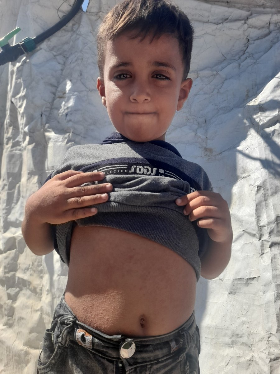 AtallaMoaz44362's tweet photo. Please…don’t scroll past.
Ahmed needs treatment .
Ahmed needs headphones .
Ahmed needs clothes.
Ahmed needs food.
Ahmed needs a chance to live.

Please don’t IGNORE this call…
Ahmed is hungry, cold, and fighting to survive. He doesn't deserve that 🙏

https://t.co/WAvUx18KxP https://t.co/eFWoHVe0Dh
