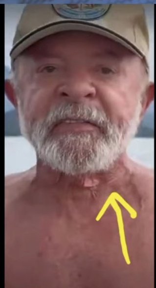 ESSE É O LULA❓️
TEM MISTÉRIOS QUE OS LEIGOS E IGNORANTES NÃO CONSEGUEM VER, MAS <a href="/juliovschneider/">Julio Schneider 🇧🇷🇺🇸</a>  e um grande número de pessoas já sabem de tdo, inclusive nosso pastor Sandro Rocha <a href="/prsandrorocha/">Pastor Sandro Rocha</a> youtube.com/live/dcXA5q4yO…