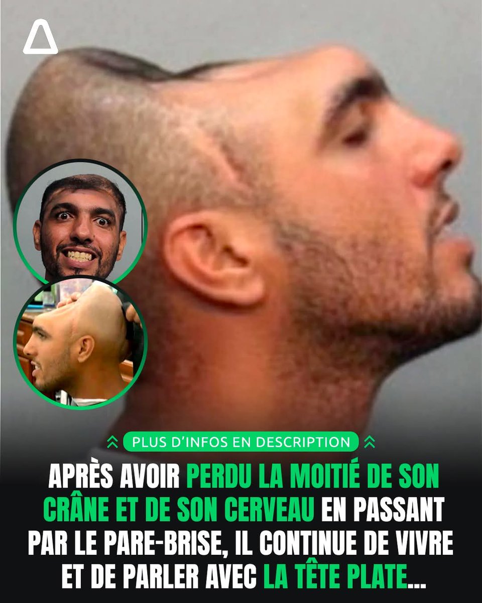 voxbyzz's tweet photo. L'accident fatidique : À Miami, Carlos Rodriguez, alors âgé de 14 ans, prend une décision qui va changer son apparence à jamais. Sous l'emprise de drogues et d'alcool, il vole une voiture et se lance dans une course folle. La virée tourne court. https://t.co/rRxdCDaPzh