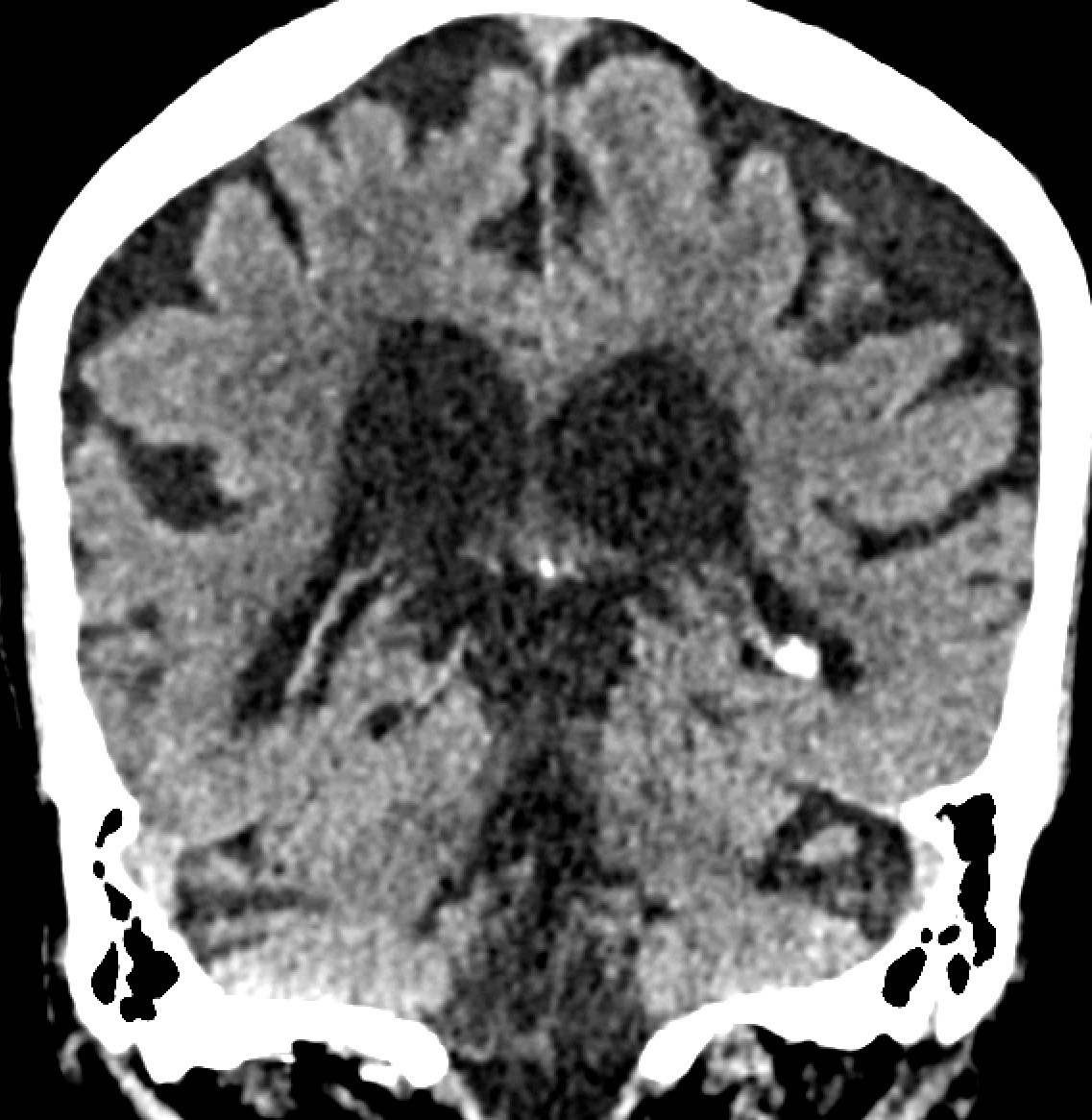 Jack Garnham tweet media