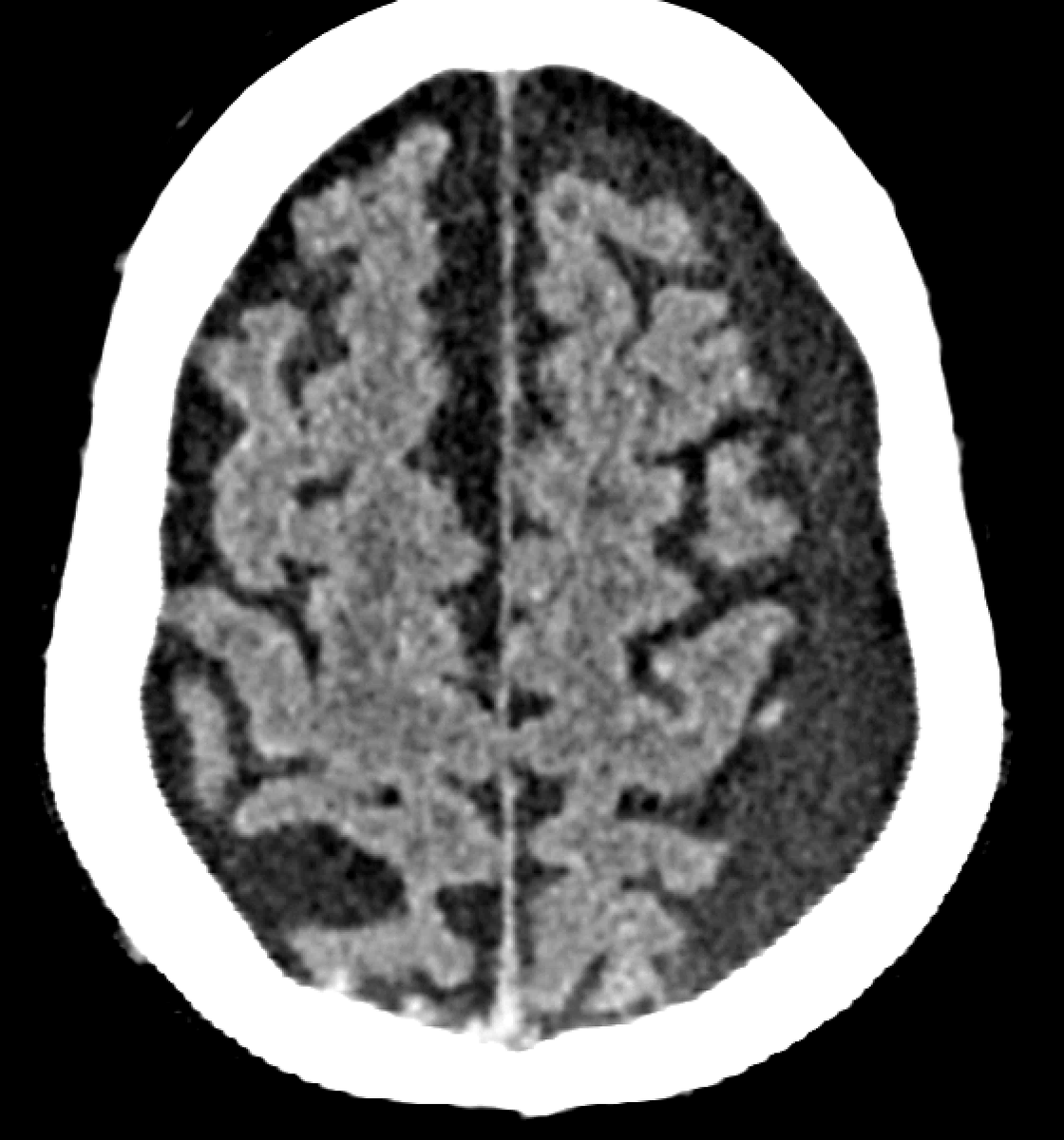 Jack Garnham tweet media