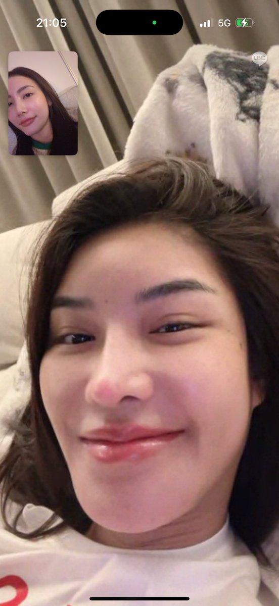 เยี่ยมไข้คนป่วย ดูจากสกิลปากแล้วไม่น่าเป็นไรมากค่ะ หายห่วง🤏🏽😜