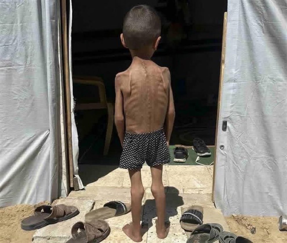 Gazze açlıktan ve soğuktan ölüyor