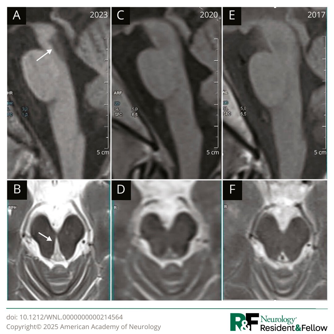 Neurology Journal tweet media