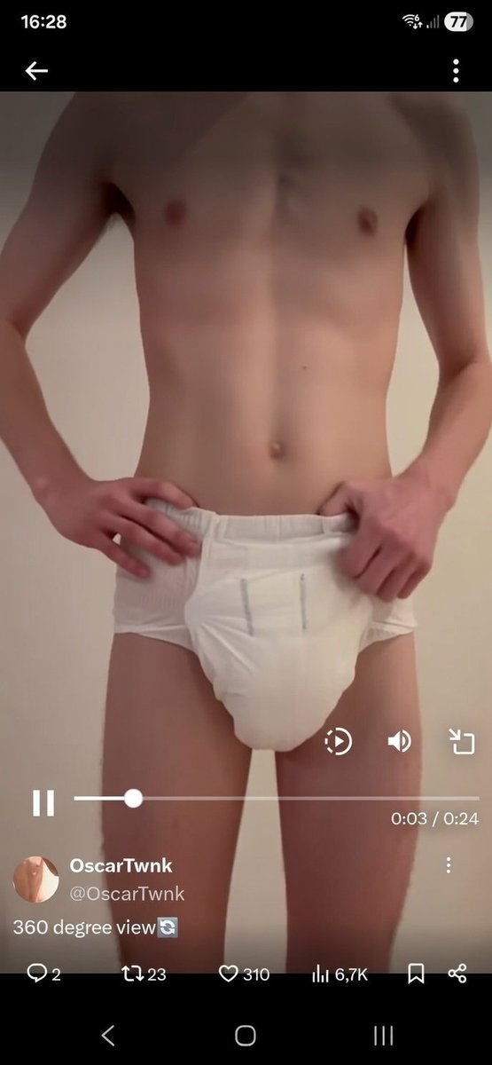 NaschGabriel's tweet photo. @OscarTwnk So sieht es besser aus👶🤪🥰 https://t.co/TuIGRV4vVx