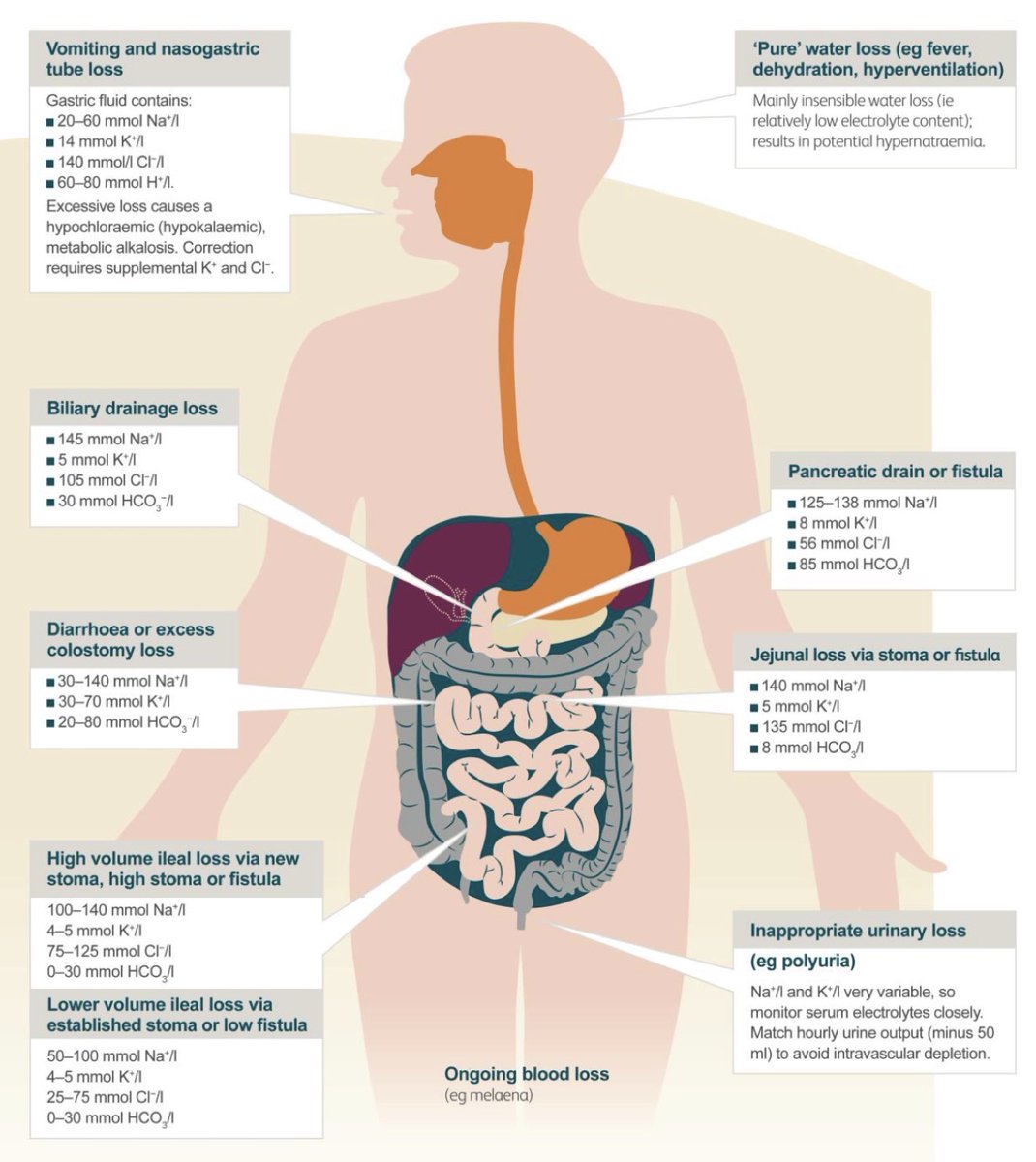 sepdigestiva's tweet photo. 💧⚡ Contenido electrolítico de los fluidos gastrointestinales
Útil para orientar la reposición de líquidos. https://t.co/XkZp7nfNpO