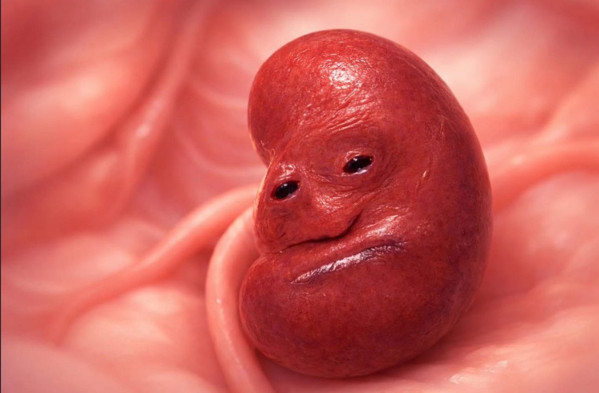 aproko_doctor's tweet image. Your kidneys watching you consume your 348th cup of roadside agbo.