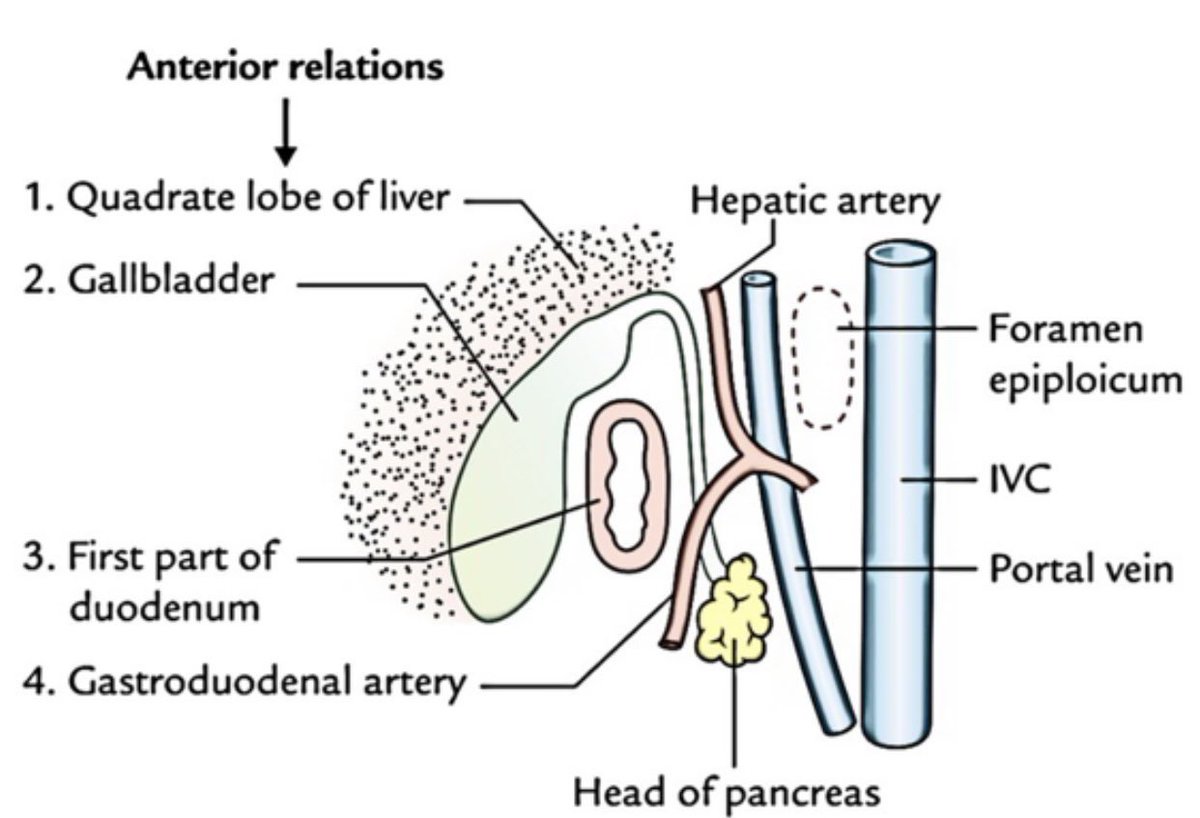 sepdigestiva's tweet photo. 🧠📚 Anatomía del duodeno #meded

Repaso de conceptos clave:
1️⃣ Longitud de sus 4 porciones 🔢
2️⃣ Referencias endoscópicas 🔦
3️⃣ Vista lateral en D1 ↩️
4️⃣ Irrigación arterial 🩸
📸: MEDizzy https://t.co/o9Gs74Xh5V