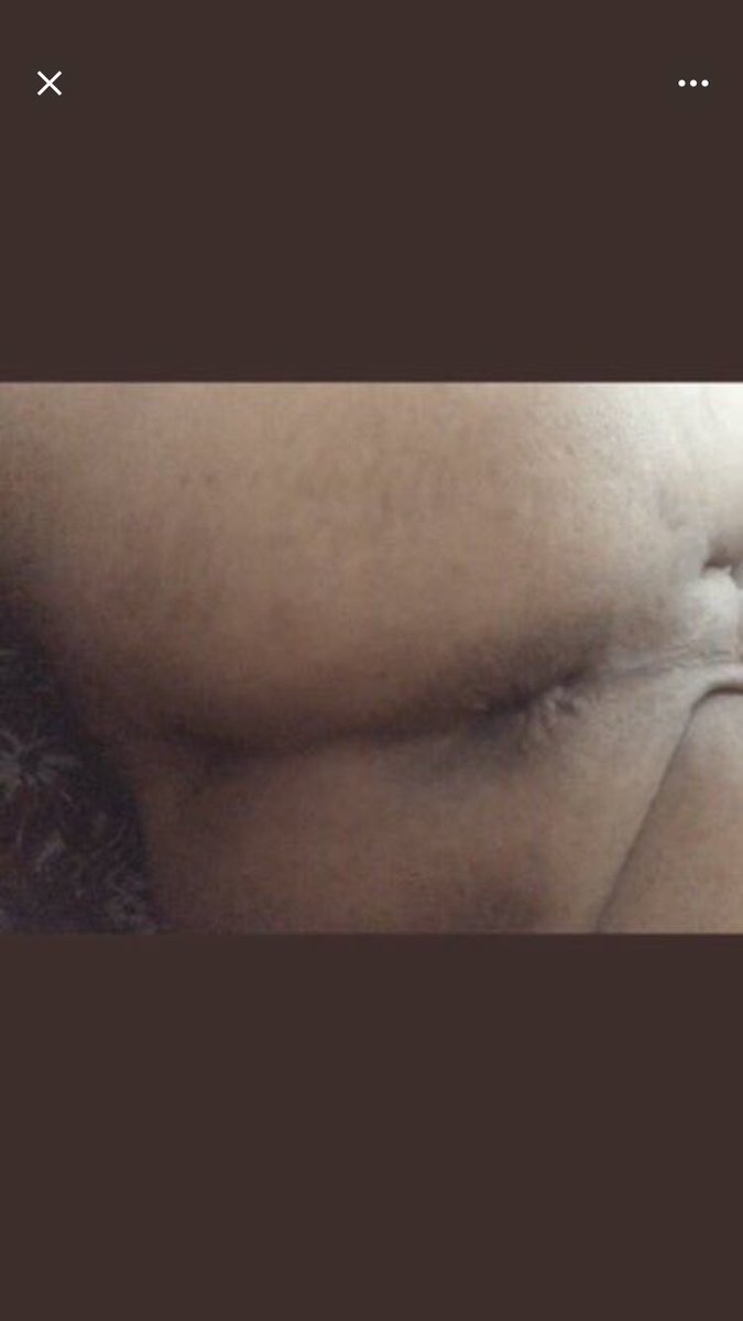 men07_black's tweet photo. Aktifler Dm ye bekliyorum sizi 😘 https://t.co/m9pY4GnQvR