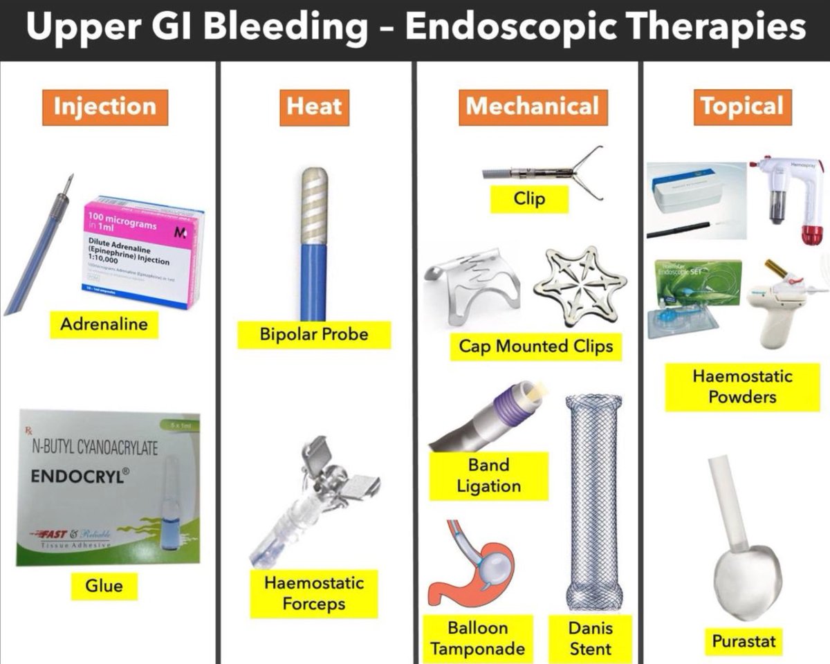 sepdigestiva's tweet photo. 🩸🆕 Revisión sobre la hemorragia digestiva alta agudaIncluye:
1️⃣ Algoritmo de manejo
2️⃣ Tratamiento endoscópico
3️⃣ Manejo de la terapia antitrombótica
4️⃣ Evolución y tendencias a lo largo del tiempo📸: @FrontGastro_BMJ
🔗 https://t.co/yeNZcg1YVn https://t.co/13UqFX2U9K