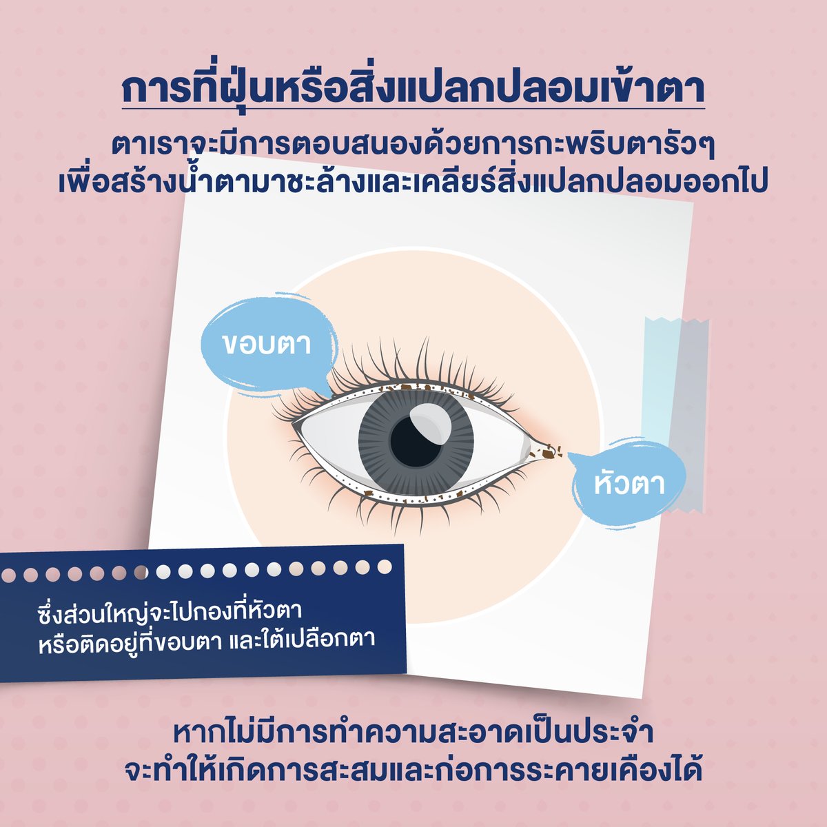 Ocusoftthailand's tweet image. เคยสงสัยไหม? ฝุ่นเข้าตาแล้วหายไปไหน?? 🤔
.
การที่ฝุ่นหรือสิ่งแปลกปลอมเข้าตา ตาเราจะมีการตอบสนองด้วยการกะพริบตารัวๆ เพื่อสร้างน้ำตามาชะล้างและเคลียร์สิ่งแปลกปลอมออกไป

ซึ่งส่วนใหญ่จะไปกองที่หัวตา หรือติดอยู่ที่ขอบตาและใต้เปลือกตา
และถ้าหากไม่มีการทำความสะอาดเป็นประจำ…