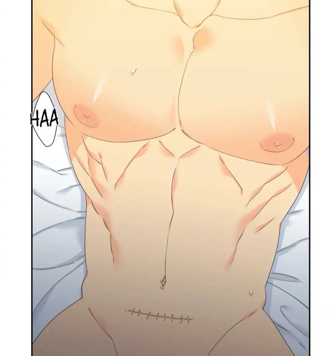 XieQingcheng__'s tweet image. será que essa é de cirurgia de apêndice tbm?