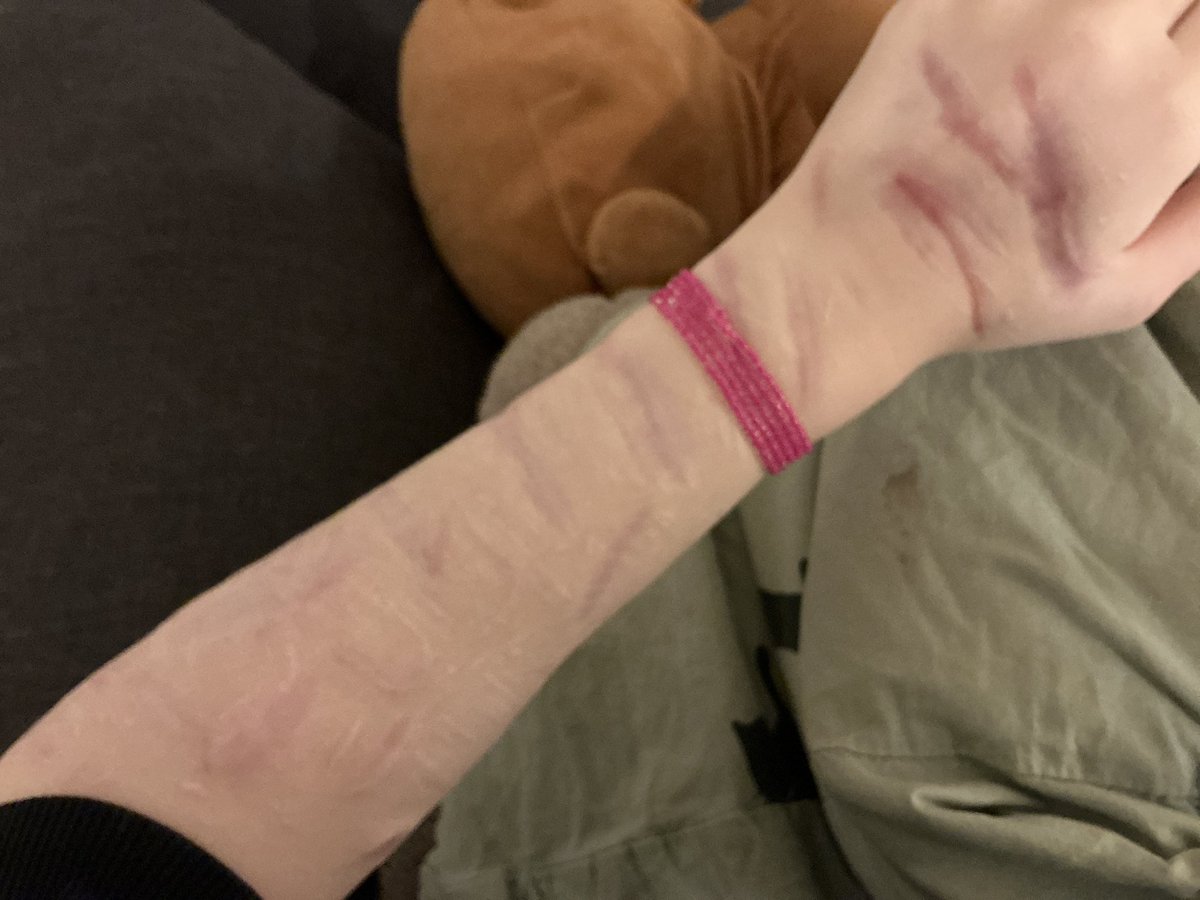 the color difference is definitely interesting in now and then