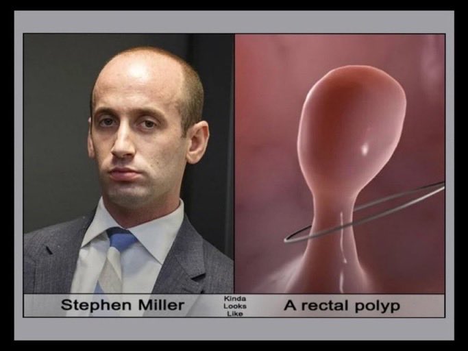 <a href="/KatieMiller/">Katie Miller</a> I can only assume Katie has a wart infested crotch that looks like a head of cauliflower, since the only man she could get is a walking anal polyp.