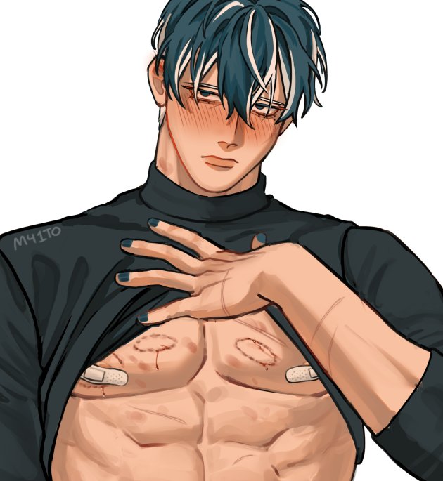 mm41to's tweet image. 🤕