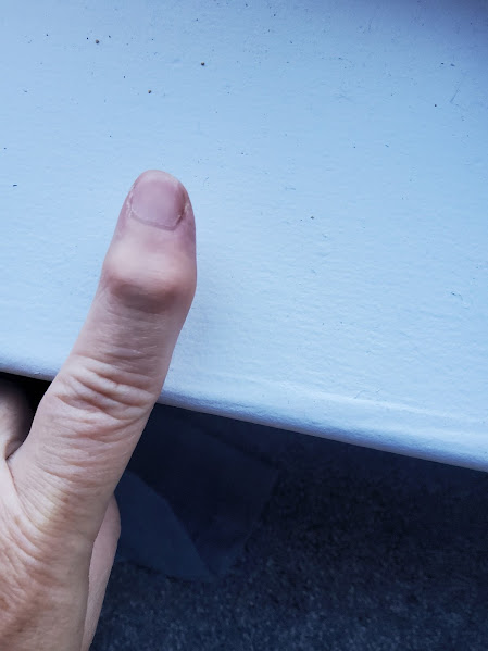 usginger's tweet image. Arthritis? Curcumin effects?  Before and after.  @grok It took 3 weeks, for ref. only.