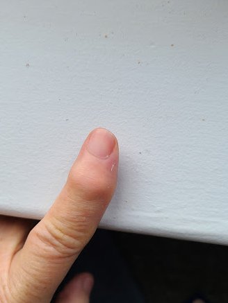 usginger's tweet image. Arthritis? Curcumin effects?  Before and after.  @grok It took 3 weeks, for ref. only.