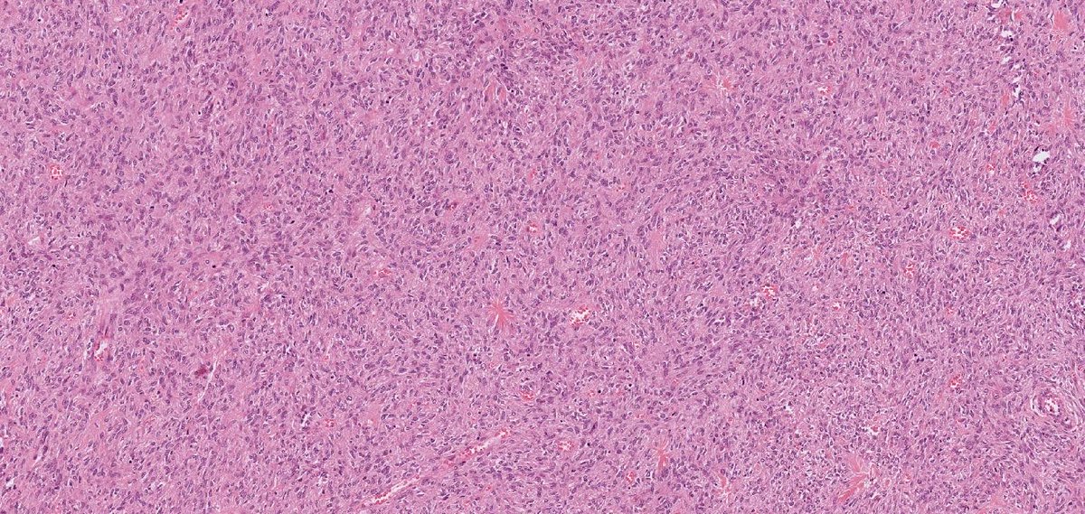 Runjan Chetty tweet media