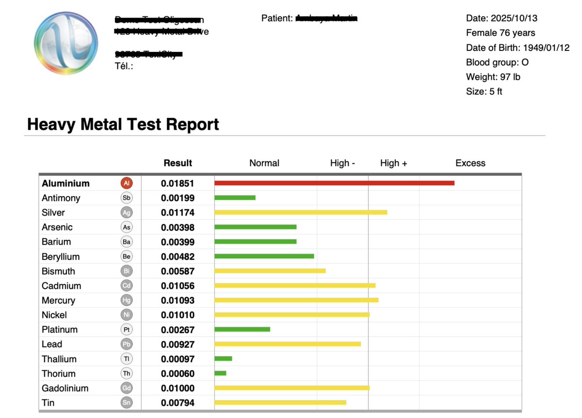 IonomeLabs's tweet image. This is what can happen if you take zeolite...This lovely woman has been on zeolite for years to "detox heavy metals". She had the highest aluminum burden of anyone we tested last year.  Like most, she didn't know that zeolite is an alumino-silicate complex that can undergo…