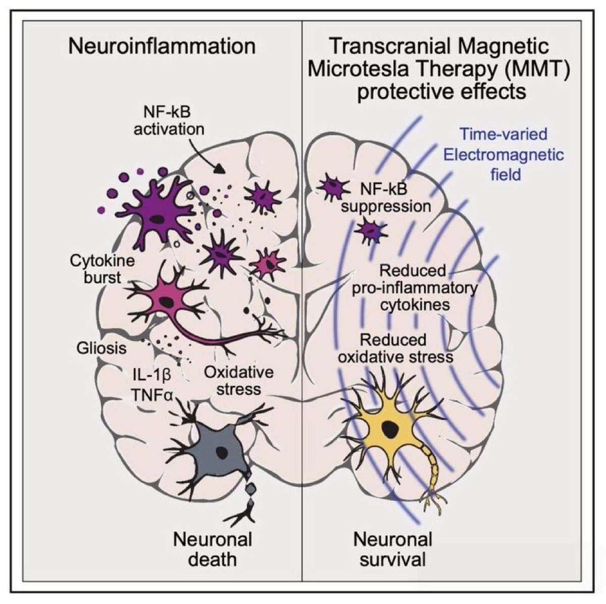 Those who are members of my site know I have been bullish on Cranial magentic stimulation to limit neuroinflammation in my NFL clients.