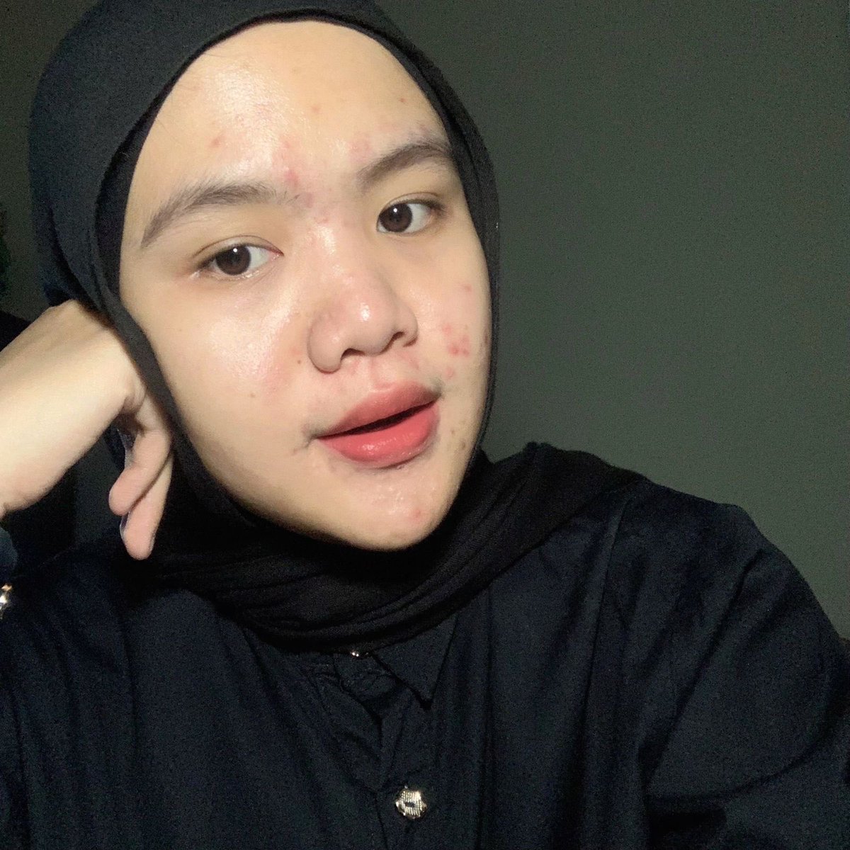 arccsia's tweet photo. definisi budget tipis tapi pengen sunscreen bagus, cobain sunscreen OMG! 💭🧾

harga 30 ribuan, dan cocok buat oily skin dan acne prone skin. &amp; udah SPF 50 PA++++, 

kulit sensitif rapatkan barisan kesini! 💌

#SunscreenOMG #SunscreenViral #SunscreenJerawat #OMGBeauty https://t.co/4sygfNivt5
