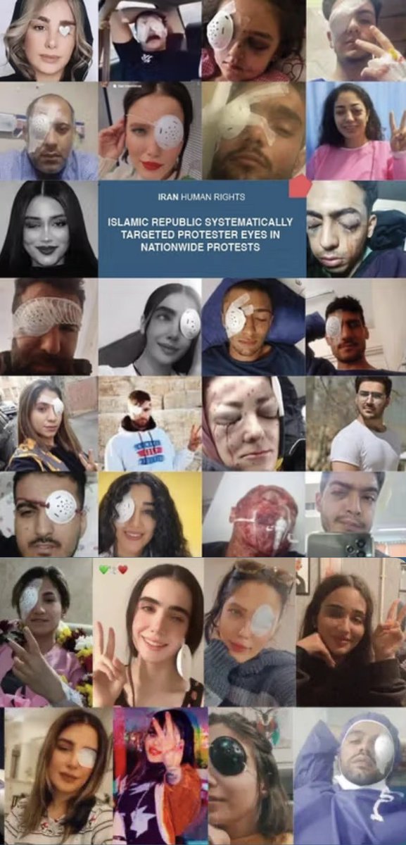 elicalebon's tweet image. Did you know that before these uprisings even began, hundreds of Iranian protesters had been blinded by security forces? The IRGC are trained to shoot protesters directly in the eye. Why? Because they want to chill dissent by the most brutal punishment: permanent disfigurement.