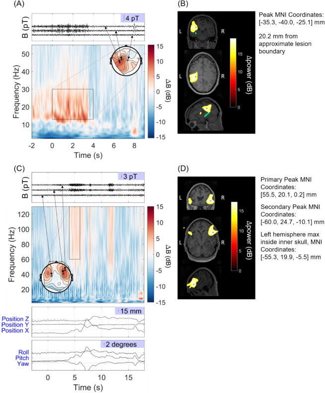 IFCN and its Clinical Neurophysiology journals tweet media