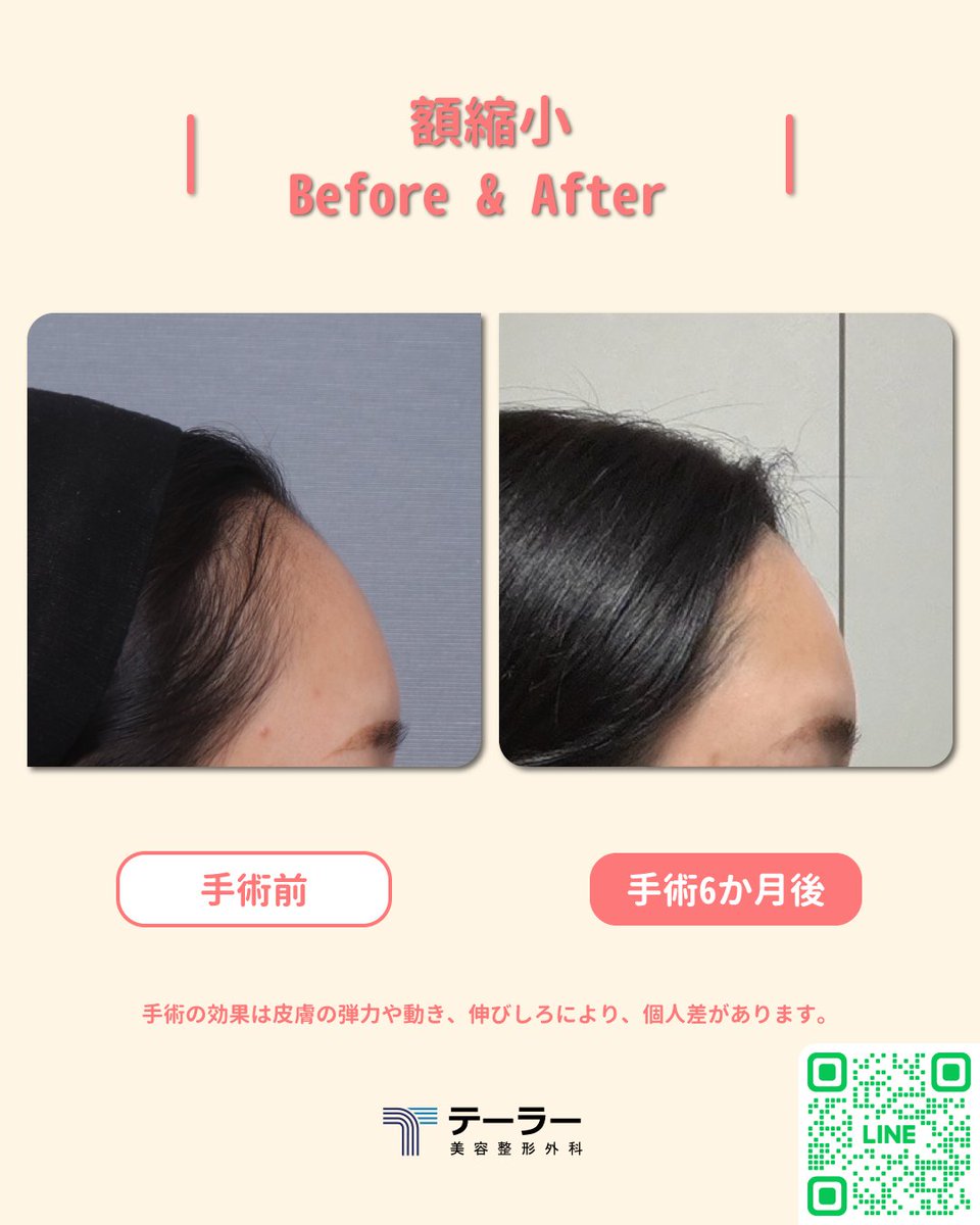 『公式』テーラー美容整形外科 tweet media