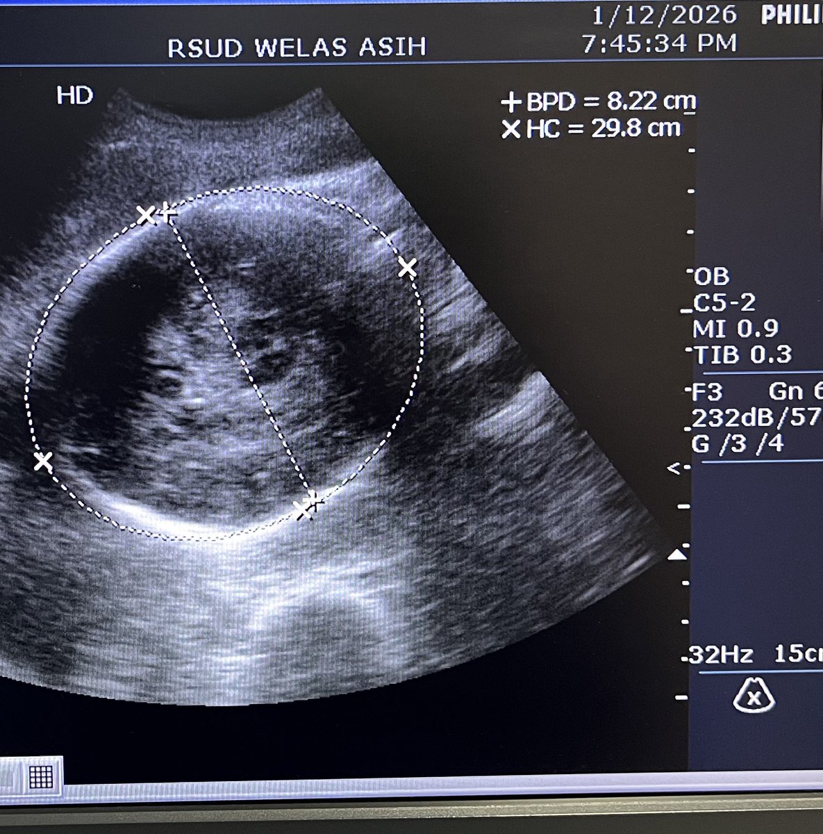 studywithblew's tweet image. welcoming stase obsgin 🤰🏻