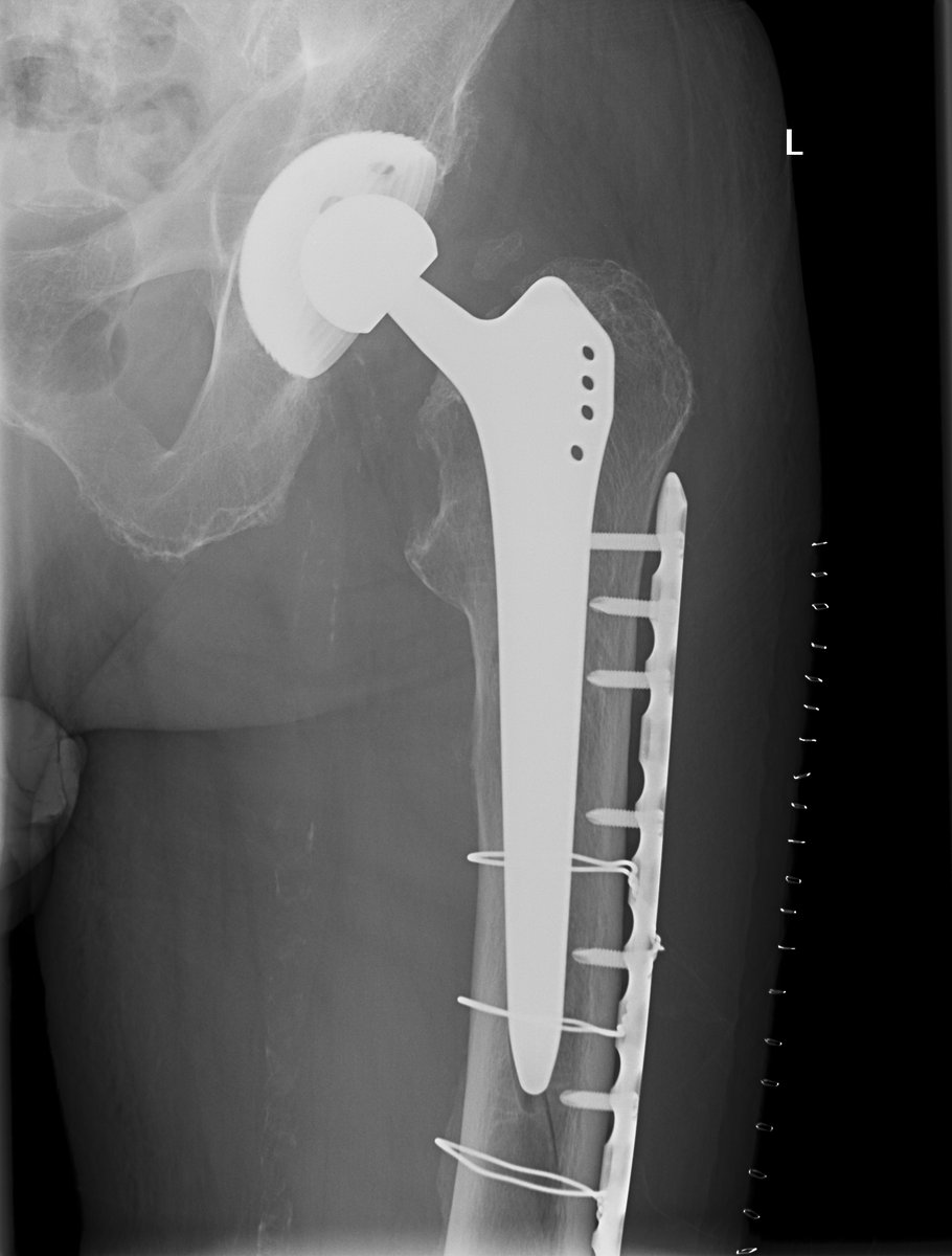 traumaticum's tweet image. not what i wanted, but this is stunning