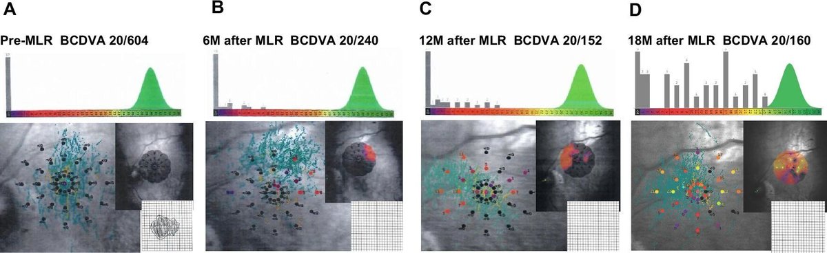 Eye Journal tweet media