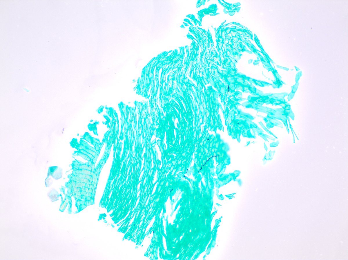 LaskorunskyiR's tweet photo. Such a relief when you don't have to spend an hour looking for them 
#skinpath https://t.co/TVoX33GiiS