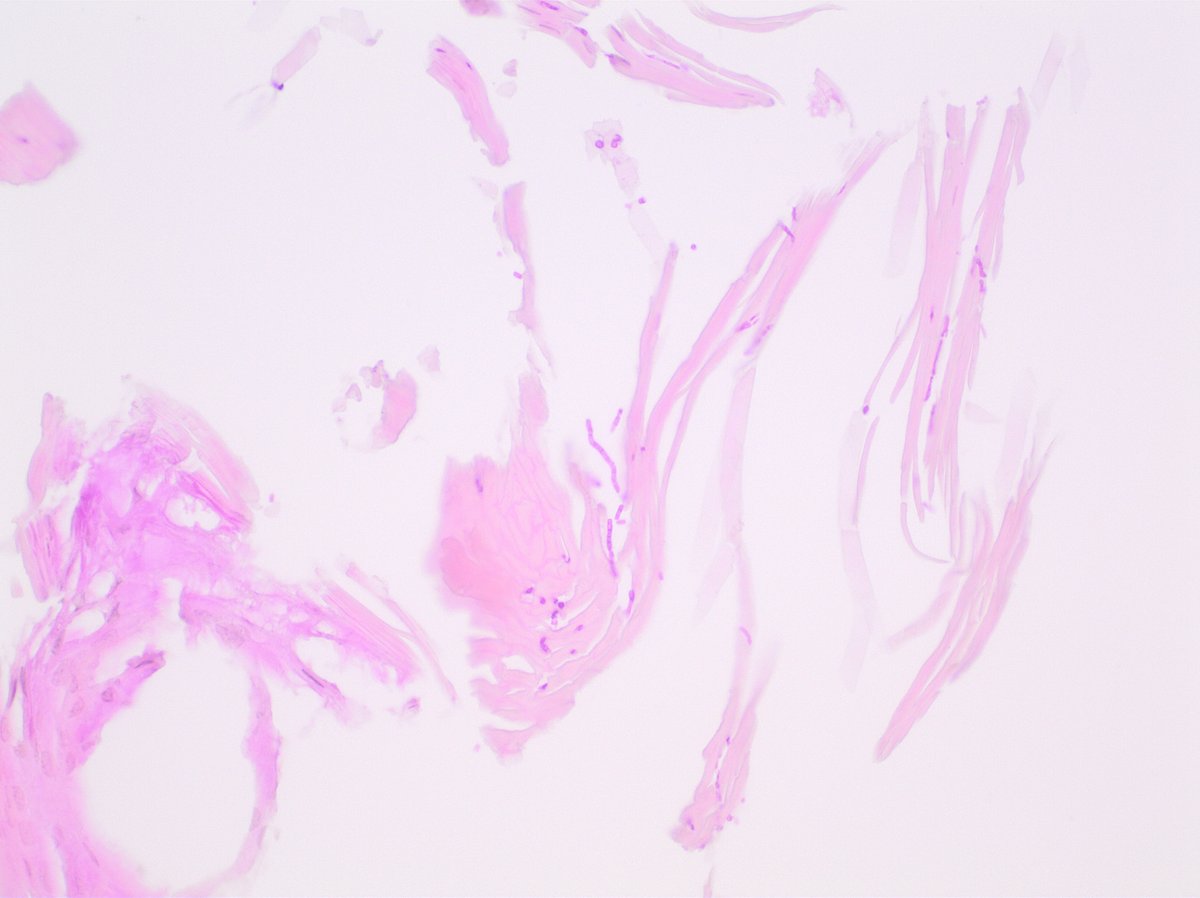 LaskorunskyiR's tweet photo. Such a relief when you don't have to spend an hour looking for them 
#skinpath https://t.co/TVoX33GiiS