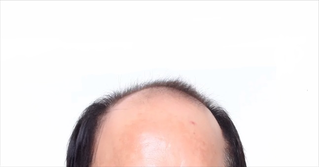 Profit_Lx's tweet image. 탭을 눌러서 남자는 머리빨이란 걸 확인하세요

Tap to see why hair makes the man