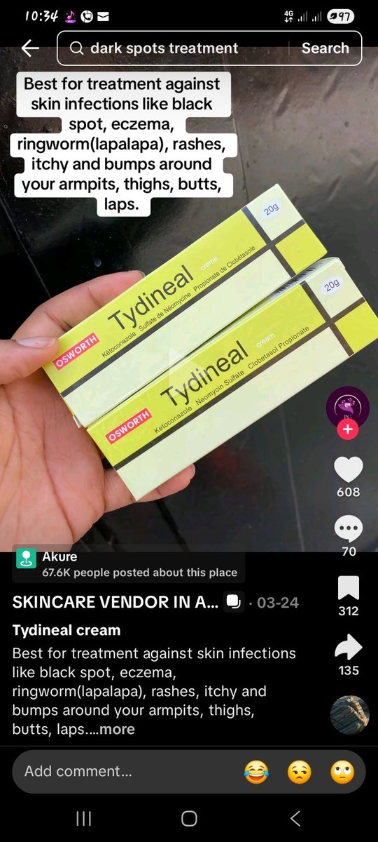 JohnDida5's tweet photo. @Baby_Beedee It's going to clear it, seriously. Very fast....go to pharmacy and get it https://t.co/PgVIr5wdgh