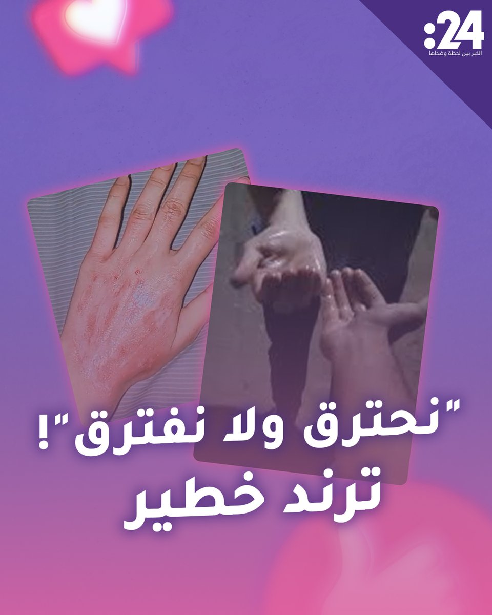 "نحترق ولا نفترق"! ترند خطير يستدعي التحذير.. ما القصة؟. ترندي 