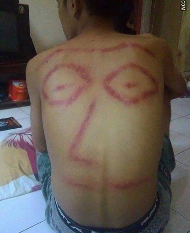 decrency's tweet image. Sini, gue kerokin.