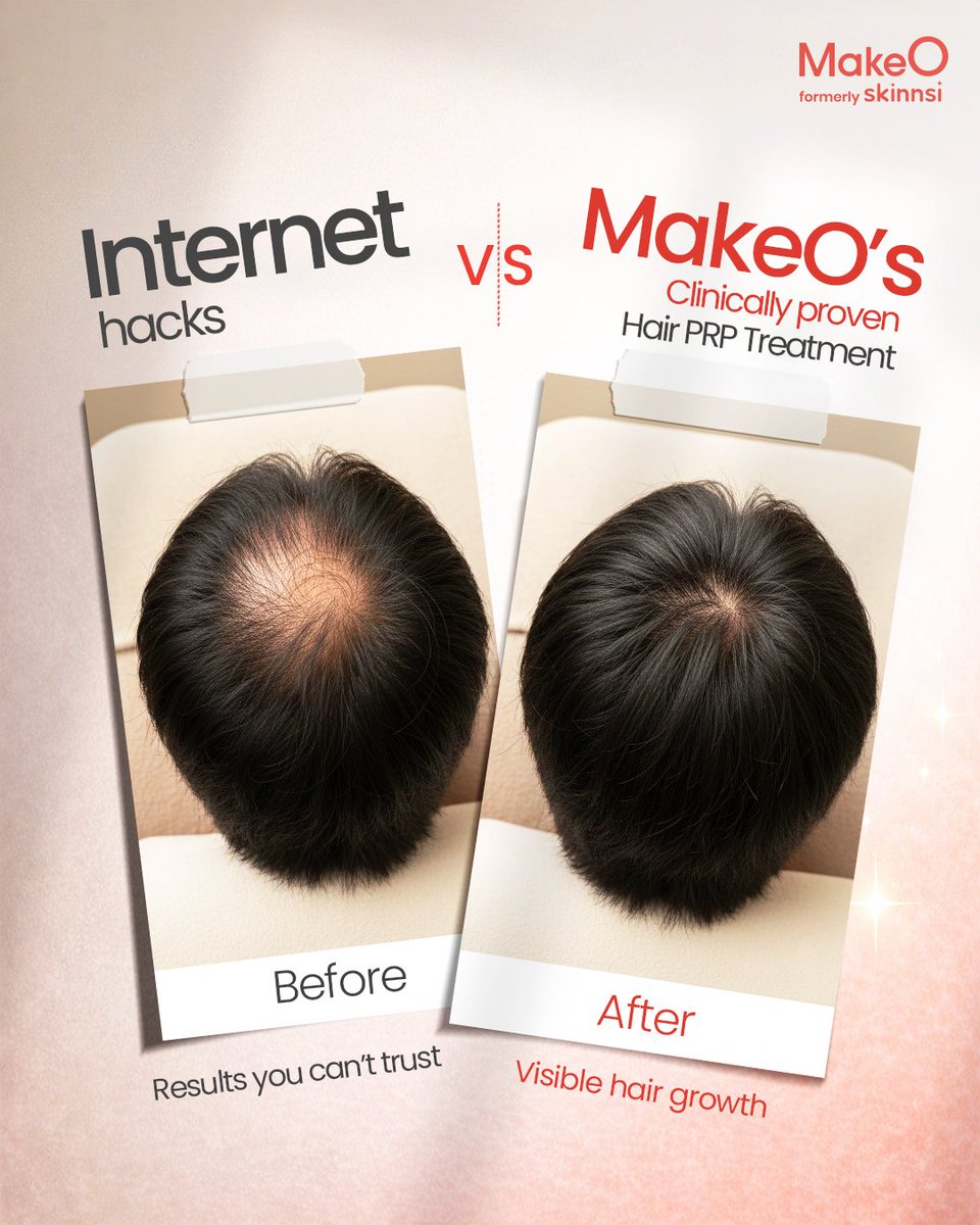 makeO_skin's tweet image. Explore lasting solutions to healthier and fuller hair at MakeO. 

Our hair growth treatments aren’t based on what’s trending - they are designed by dermatologist for visible results. 

Book a free consultation to speak to our experts.

#MakeO #GlowingSkin #MakeOver #SmoothSkin