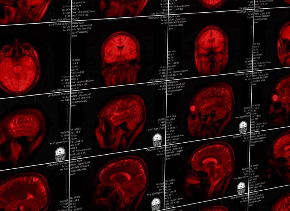 TuiteroSismico's tweet image. El Pentágono habría"comprado" el arma del "Síndrome de La Habana" según CNN
Y Fue utilizada En el operativo de extracción de Maduro. 
El dispositivo supuestamente produce ondas de radio pulsadas, una posible causa de "episodios de salud anómalos".

Funcionarios estadounidenses lo…