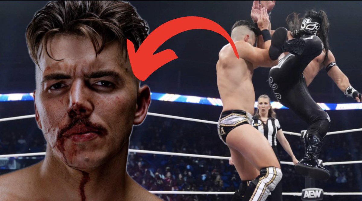 sammyguevara's tweet image. “New Year, New… BROKEN NOSE” - Vlog 454 ▶️ youtu.be/e-J-KZAnT1A?si…