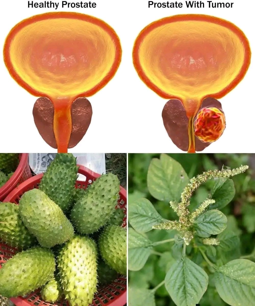 Herbalisque's tweet image. No Man Should Die From Prostate Cancer 💪🌿A powerful natural remedy every man should know 👀✨
🍈 Soursop (Graviola / Annona muricata) – Used in traditional remedies; enjoyed in juices, smoothies &amp;amp; desserts
🌱 Wild Amaranth , Nutrient-rich, packed with vitamins &amp;amp; minerals (cook…