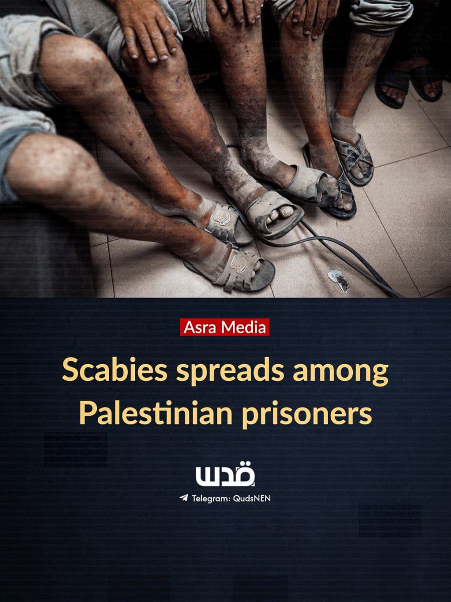 QudsNen's tweet image. According to Asra Media, the spread of skin diseases, particularly scabies, among Palestinian detainees become a grave threat to their lives.  

Israel triggered these conditions by preventing the entry of hygiene products and denying detainees adequate medical treatment.